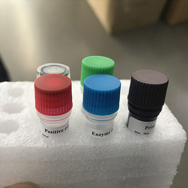 Novel Coronavirus (2019-nCoV) Nucleic Acid Detection Kit (Fluorescence PCR)